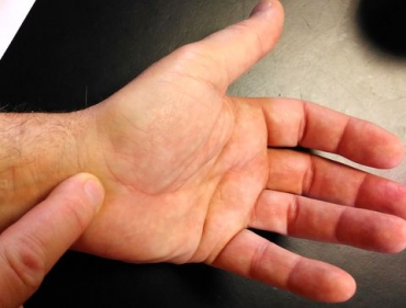 autodiagnostic de la douleur du poignet, depuis la paume de la main.